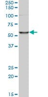 IHC-plus™ Monoclonal Mouse anti-Human CORO1C Antibody (clone 1F7, IHC, WB)
