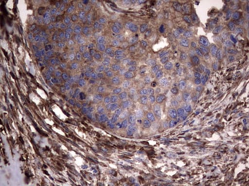 PKM2 Antibody (clone 14C7)