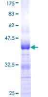 Human AUTS2 Protein (Recombinant GST, N-terminus)