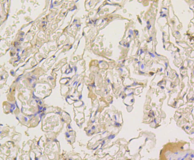 ARRB1 / Beta Arrestin 1 Antibody