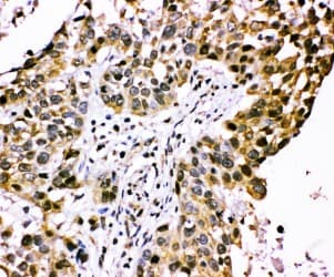 CISH / SOCS Antibody (aa241-258)