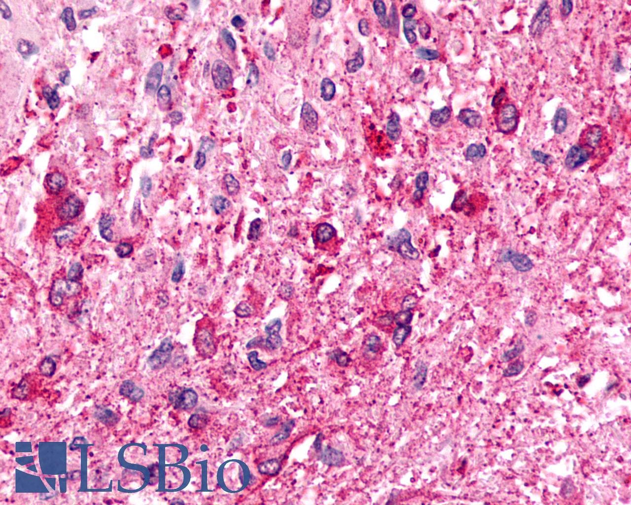 IHC-plus™ CXCR6 Antibody (C-Terminus)
