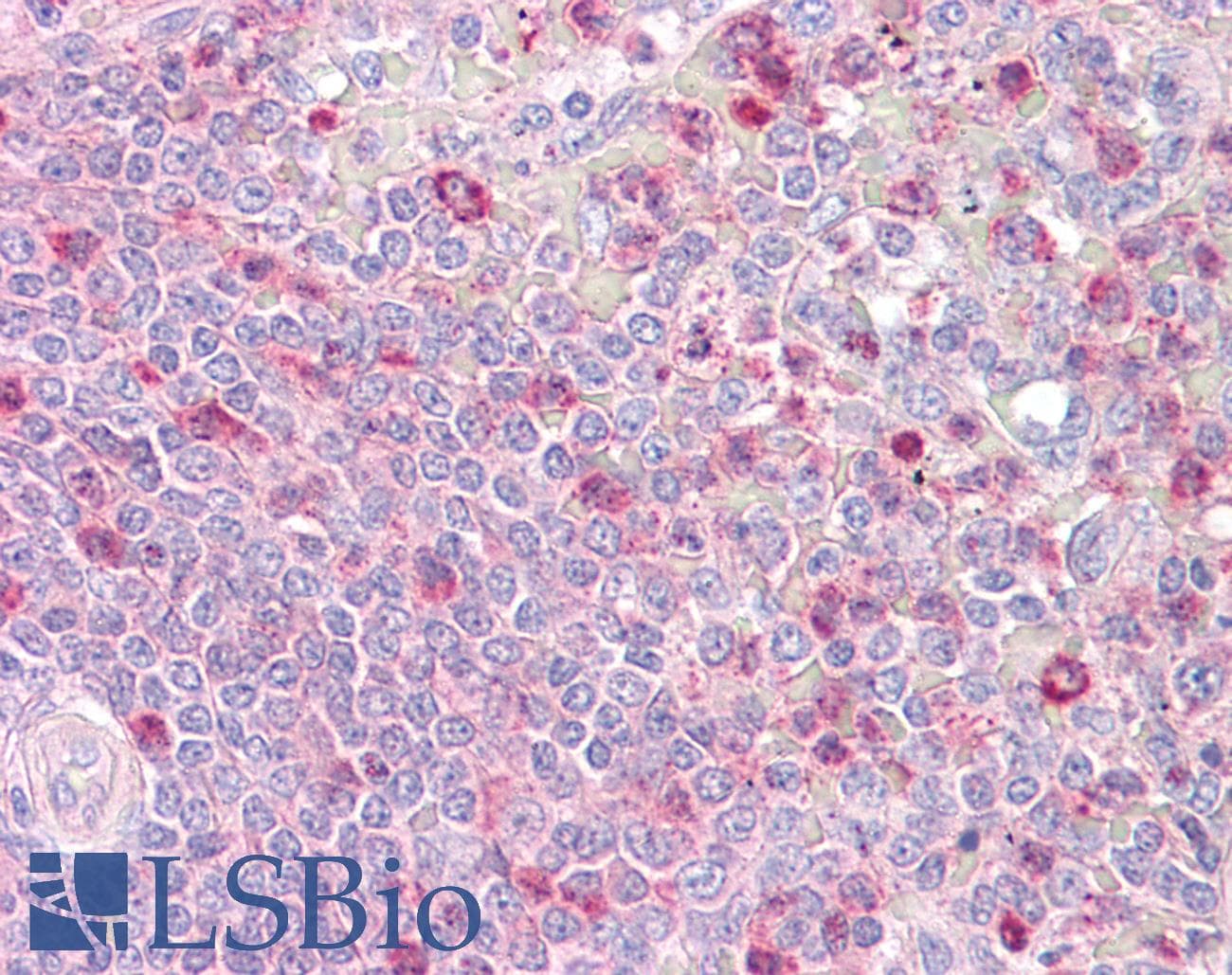 IHC-plus™ PTK2B / PYK2 Antibody