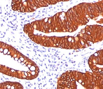 KRT19 / CK19 / Cytokeratin 19 Antibody (clone A53-B/A2.26, Azide-free, BSA-free)