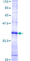 Human XCL1 / Lymphotactin Protein (Recombinant GST, N-terminus)