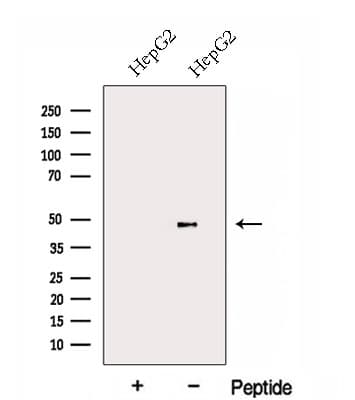FBXL14 Antibody
