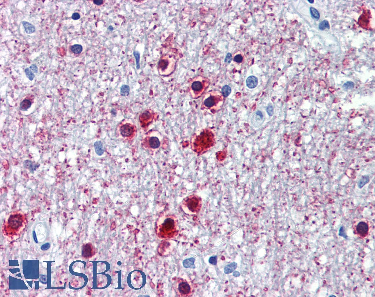 ONECUT1 / HNF6 Antibody (C-Terminus)