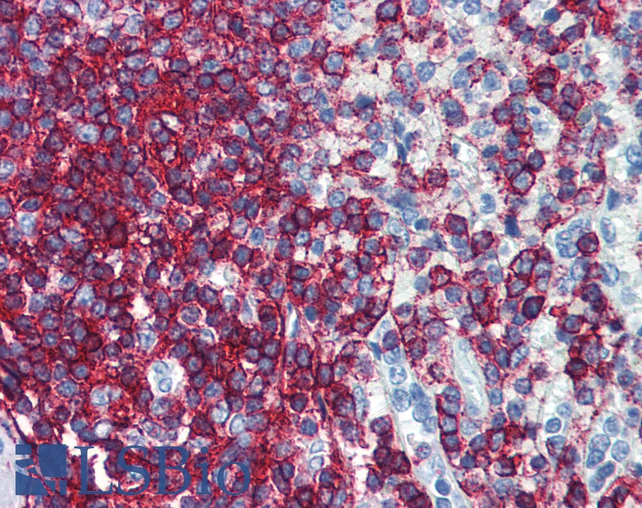 IHC-plus™ CD44 Antibody (clone F10-44-2, FITC)