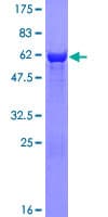 Human DDH / AKR1C1 Protein (Recombinant GST)