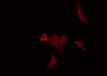 Polyclonal Rabbit anti-Human CTSG / Cathepsin G Antibody (IHC, IF, WB)
