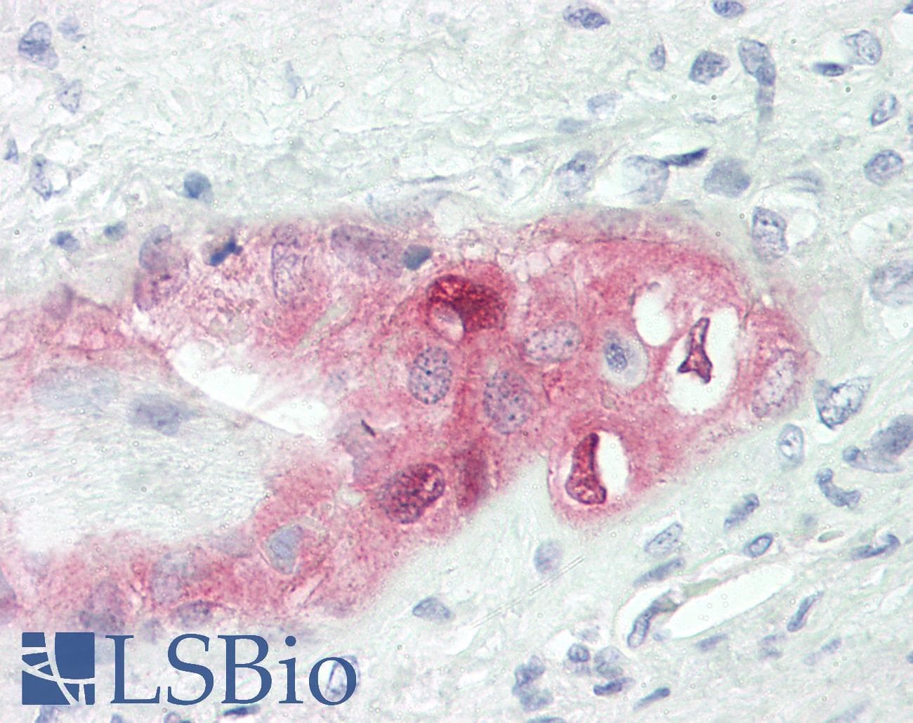 CCDC6 Antibody