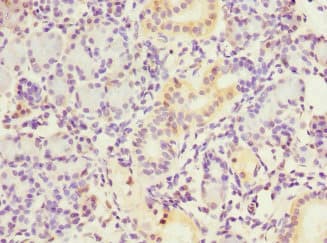 Polyclonal Rabbit anti-Human NT5C3A Antibody (IHC)