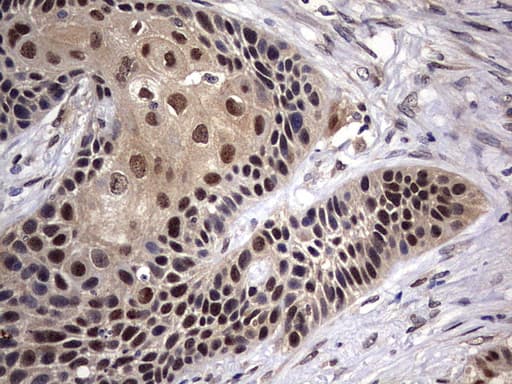 Monoclonal Mouse anti-Human FEN1 Antibody (clone OTI3A8, aa117-380, IHC, WB)