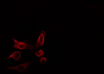 Polyclonal Rabbit anti-Human RHOBTB2 / DBC2 Antibody (IF, WB)