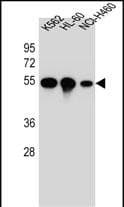 TUBB8P12 / Tubulin beta-8 Antibody (aa 253-280, C-term)