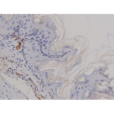 Polyclonal Rabbit anti-Human STAT1 Antibody (phospho-Tyr701, IHC, IF, WB)
