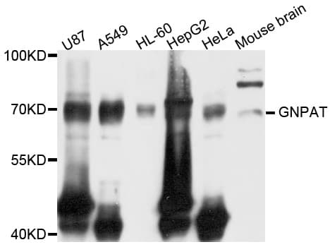 Polyclonal Rabbit anti-Human GNPAT / DHAP-AT Antibody (WB)