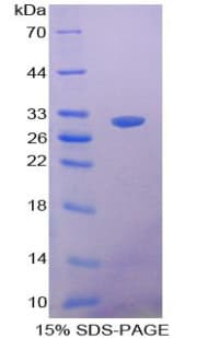Dog CLU / Clusterin Protein (Recombinant His-S)