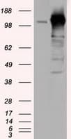 ERIC-1 / TACC3 Antibody (clone OTI7B11)