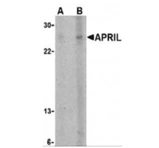 Polyclonal Rabbit anti-Human TNFSF13 / APRIL Antibody (aa50-100, WB)