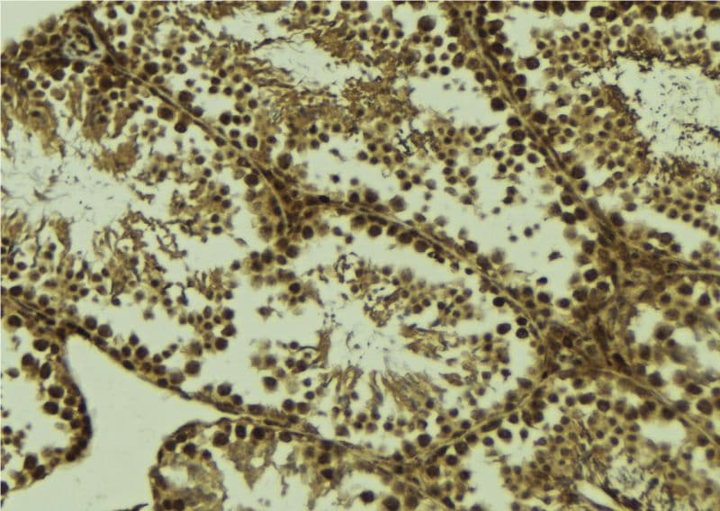HSPB9 Antibody