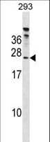 Polyclonal Rabbit anti-Human HTATSF1 / TAT-SF1 Antibody (aa152-179, WB)
