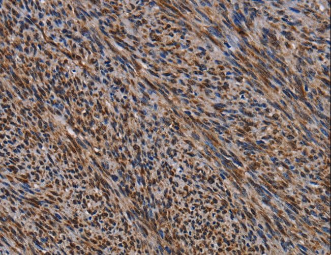 KIF1C Antibody