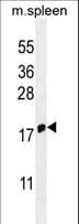 IHC-plus™ IFITM5 Antibody (aa55-83)