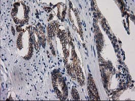 ACY3 Antibody (clone OTI4H7)