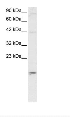 APOBEC3G / CEM15 Antibody (aa51-100)
