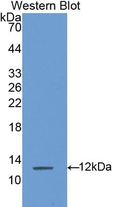 S100A8 / MRP8 Antibody (aa1-89, APC)