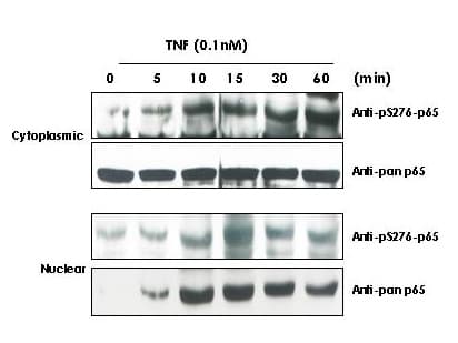 RELA / NFKB p65 Antibody (phospho-Ser276)
