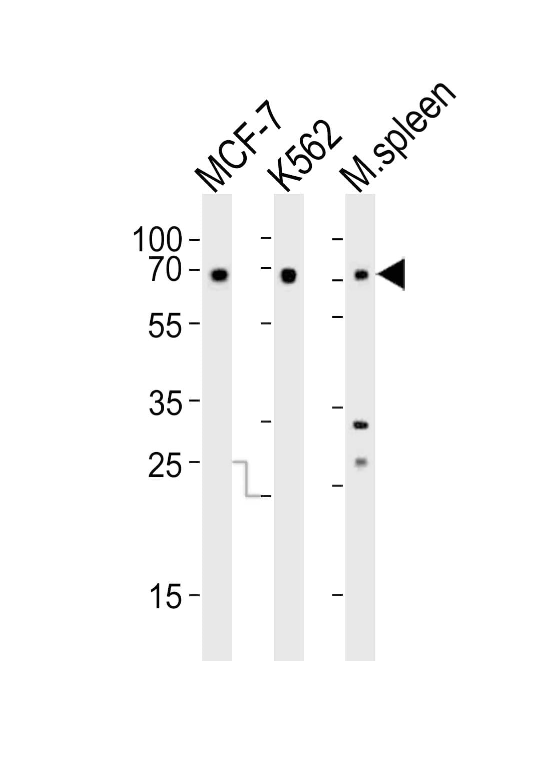 Polyclonal Rabbit anti-Human RBBP5 Antibody (aa451-485, WB)