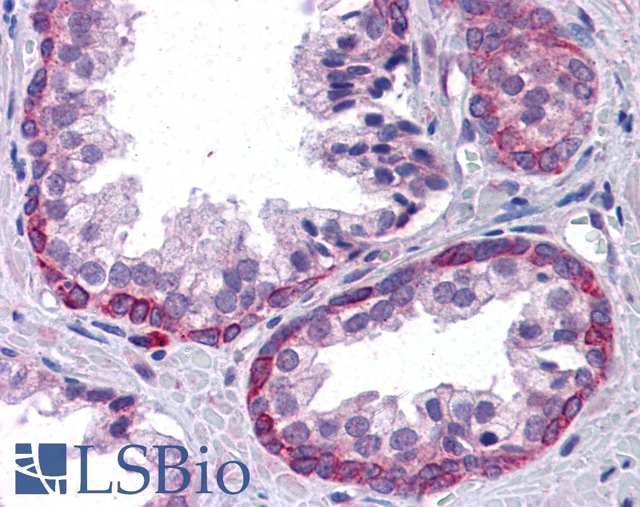 IHC-plus™ Polyclonal Goat anti-Human KPNA6 Antibody (aa74-87, IHC, WB)