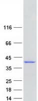 Human ANKRD2 Protein (Recombinant Myc-DDK (Flag))