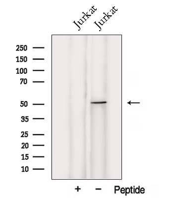 UMPS / OPRT Antibody