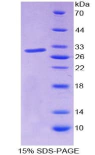 Human JUN / c-Jun Protein (Recombinant His, N-terminus)
