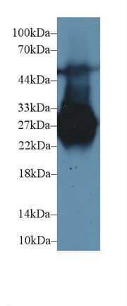MBL2 / Mannose Binding Protein Antibody (aa19-244, Cy3)