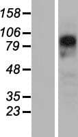 PYGL Protein (Over-Expression Lysate Myc-DDK (Flag))