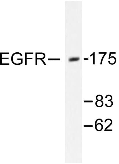 EGFR Antibody (His672)