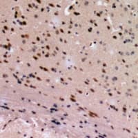 CBR4 Antibody