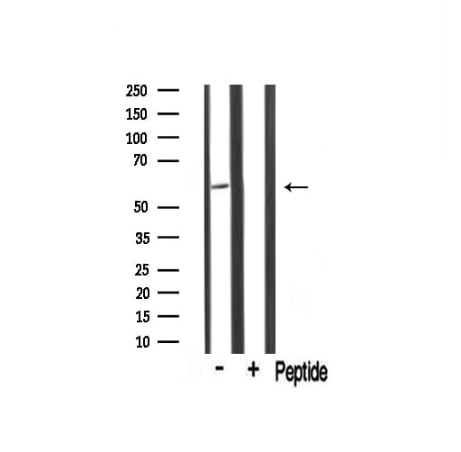 TRIM16 Antibody