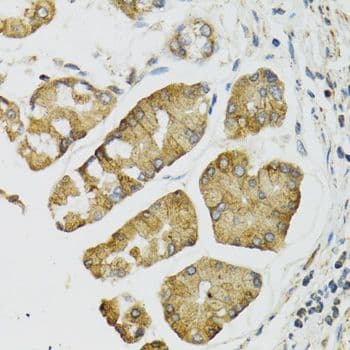 PI3 / Elafin Antibody