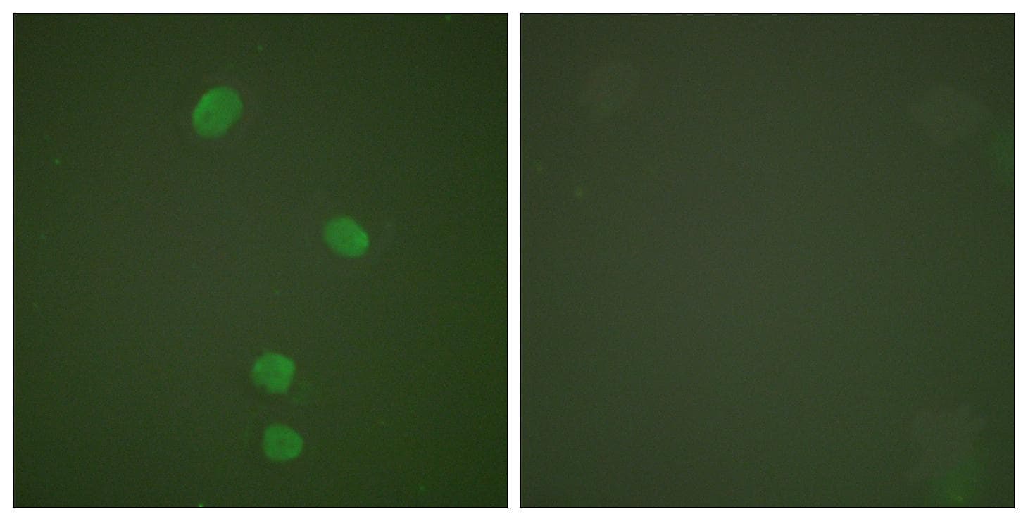 Polyclonal Rabbit anti-Human MCM5 Antibody (IHC, IF, WB)
