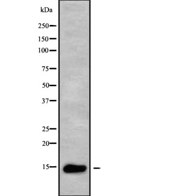 ZNRD1 Antibody
