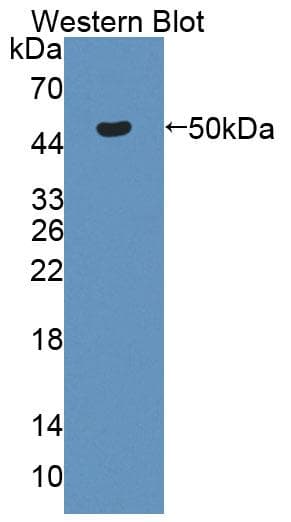 CKB / Creatine Kinase BB Antibody (aa11-367)