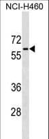 Polyclonal Rabbit anti-Human PGM5 / Aciculin Antibody (aa404-430, WB)