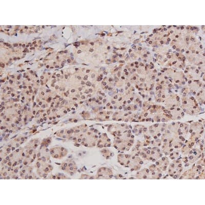Polyclonal Rabbit anti-Human c-Kit / CD117 Antibody (IHC, IF, WB)