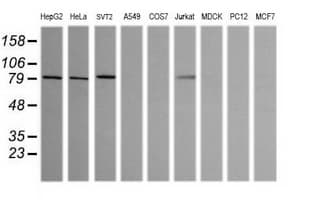 SOLO / SESTD1 Antibody (clone OTI2E7)