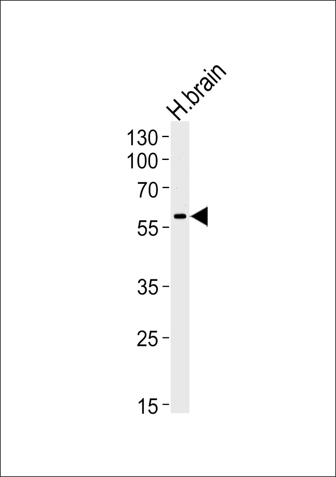 IHC-plus™ ERVWE1 / HERV / Syncytin Antibody (aa400-429)